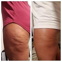 “The Only Thing That Actually Worked" - <br/>The 4-Month Sculpt & Glow Cycle