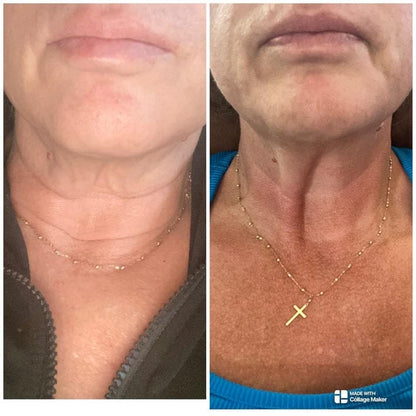 “The Only Thing That Actually Worked" - <br/>The 4-Month Sculpt & Glow Cycle