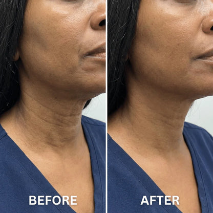 “My Turkey Neck is the Thing of the Past" - <br/>The 4-Month Sculpt & Glow Cycle (Copy)