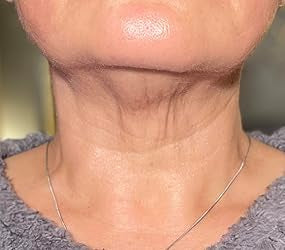 “My Turkey Neck is the Thing of the Past" - <br/>The 4-Month Sculpt & Glow Cycle (Copy)
