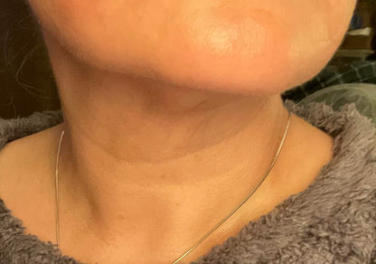 “My Turkey Neck is the Thing of the Past" - <br/>The 4-Month Sculpt & Glow Cycle (Copy)